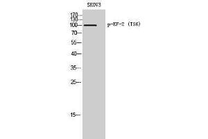 Western Blotting (WB) image for anti-Eukaryotic Translation Elongation Factor 2 (EEF2) (pThr56) antibody (ABIN3179735) (EEF2 antibody  (pThr56))