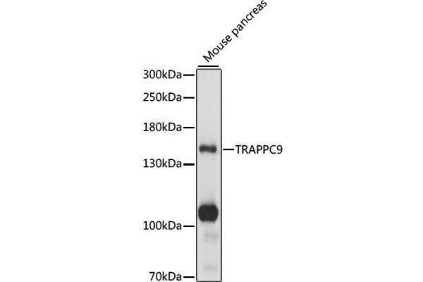 TRAPPC9 anticorps  (AA 947-1246)