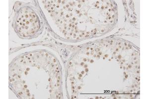 Immunoperoxidase of monoclonal antibody to MSX2 on formalin-fixed paraffin-embedded human testis.