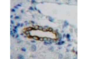 #VALUE! (ICAM-3/CD50 antibody  (AA 259-491))