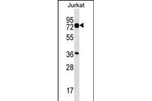 PLS1 Antibody (C-term) (ABIN657071 and ABIN2846234) western blot analysis in Jurkat cell line lysates (35 μg/lane). (PLS1 antibody  (C-Term))