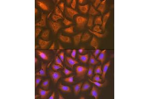 Immunofluorescence analysis of U-2 OS cells using U Rabbit mAb (ABIN7271211) at dilution of 1:100 (40x lens). (UAP1 antibody)