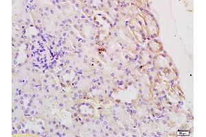 Formalin-fixed and paraffin embedded rat kidney tissue labeled with Anti-HAVCR1/TIM1/KM1 Polyclonal Antibody, Unconjugated (ABIN749528) at 1:200 followed by conjugation to the secondary antibody and DAB staining (HAVCR1 antibody)