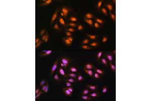 Immunofluorescence analysis of U2OS cells using  Rabbit pAb (ABIN1678593, ABIN3018971, ABIN3018972 and ABIN6220651) at dilution of 1:100.