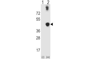 Western Blotting (WB) image for anti-Alcohol Dehydrogenase 5 (Class III), chi Polypeptide (ADH5) antibody (ABIN3003804)
