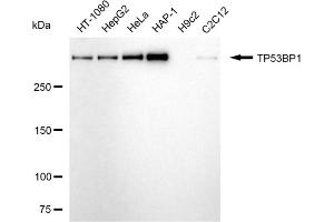 Western blotting analysis using TP53BP1 antibody (ABIN7800690). (TP53BP1 antibody)