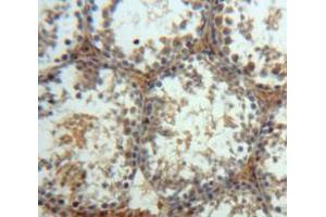 Used in DAB staining on fromalin fixed paraffin-embedded Testis tissue (MAPK10 antibody  (AA 88-332))