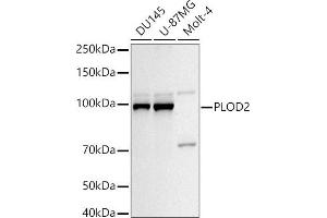 Western blot analysis of extracts of various cell lines, using PLOD2/LH2 antibody (ABIN6132888, ABIN6145788, ABIN6145790 and ABIN6222693) at 1:1000 dilution.