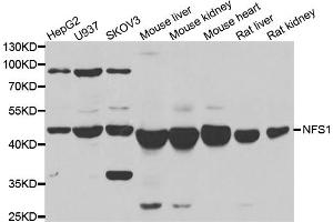 Western blot analysis of extracts of various cell lines, using NFS1 antibody (ABIN5974019) at 1/1000 dilution. (NFS1 antibody)