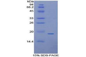 SDS-PAGE (SDS) image for Annexin A4 (ANXA4) (AA 11-164) protein (His tag) (ABIN1078823)
