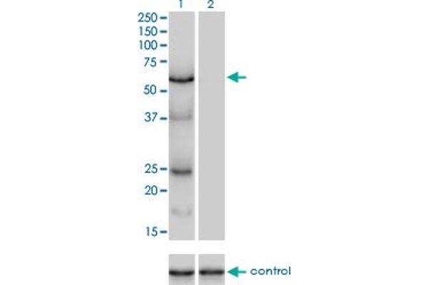 PAP Associated Domain Containing 7 (PAPD7) (AA 2-110) Antikörper