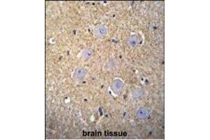 Immunohistochemistry (Paraffin-embedded Sections) (IHC (p)) image for anti-Olfactory Receptor, Family 2, Subfamily T, Member 3 (OR2T3) (AA 280-308), (C-Term) antibody (ABIN655863)