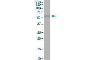 PIGW monoclonal antibody (M05), clone 1D8. (PIGW antibody  (AA 399-447))