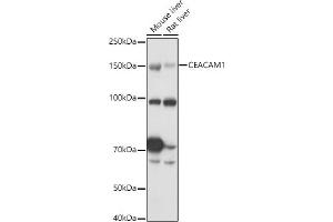 Western blot analysis of extracts of various cell lines, using CE antibody (ABIN3015546, ABIN3015547, ABIN3015548 and ABIN6218802) at 1:1000 dilution. (CEACAM1 antibody  (AA 300-430))