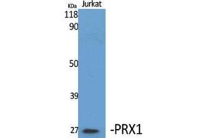 Western Blotting (WB) image for anti-Paired Related Homeobox 1 (PRRX1) (Internal Region) antibody (ABIN3186573) (PRRX1 antibody  (Internal Region))