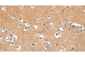 Immunohistochemistry of paraffin-embedded Human brain tissue using LRP3 Polyclonal Antibody at dilution 1:80 (LRP3 antibody)