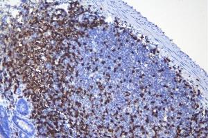 IHC analysis of CD5 using anti-CD5 antibody (ABIN7600839).