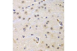 Immunohistochemistry of paraffin-embedded rat brain using CCNG1 antibody at dilution of 1:200 (400x lens).