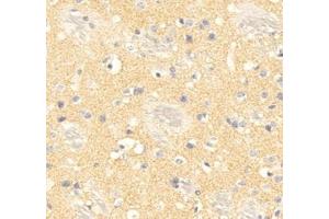 Immunohistochemistry analysis of paraffin embedded mouse brain using PPP2R2C (ABIN7075278) at dilution of 1: 500