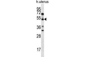 ABRA Antibody (C-term) western blot analysis in human normal Uterus cell line lysates (35ug/lane). (ABRA antibody  (C-Term))