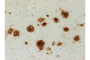 Immunostaining of paraffin embedded brain section from an Alzheimer´s patient (dilution 1 : 500). (Abeta 38/40/42 (AA 1-16), (AA 4-16) antibody)
