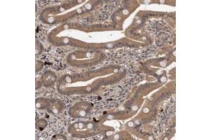 Immunohistochemical staining of human duodenum with VPS37A polyclonal antibody  shows moderate cytoplasmic positivity in glandular cells at 1:200-1:500 dilution. (VPS37A antibody)