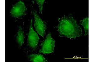 Immunofluorescence (IF) image for anti-TGF-beta Activated Kinase 1/MAP3K7 Binding Protein 1 (TAB1) (AA 3-100) antibody (ABIN564552)