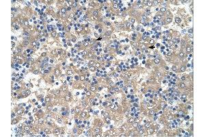 Immunohistochemistry (IHC) image for anti-BRICK1, SCAR/WAVE Actin-Nucleating Complex Subunit (BRK1) (Middle Region) antibody (ABIN2784463) (BRK1 antibody  (Middle Region))