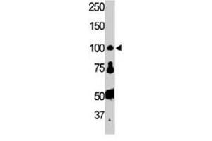 The FER polyclonal antibody  is used in Western blot to detect FER in HL-60 cell lysate.