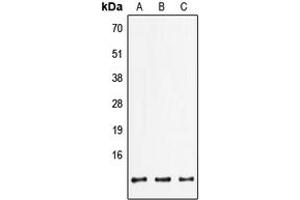 Western blot analysis of FXYD2 expression in HepG2 (A), mouse lung (B), rat brain (C) whole cell lysates. (FXYD2 antibody  (C-Term))