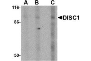 Image no. 1 for anti-Disrupted in Schizophrenia 1 (DISC1) (Middle Region) antibody (ABIN318901) (DISC1 antibody  (Middle Region))