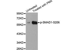 Western blot analysis of extracts from HeLa cells using Phospho-SMAD1-S206 antibody (ABIN2987857). (SMAD1 antibody  (pSer206))