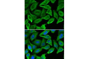 Immunofluorescence analysis of A549 cells using IFNA1 antibody (ABIN5970112). (IFNA1 antibody)