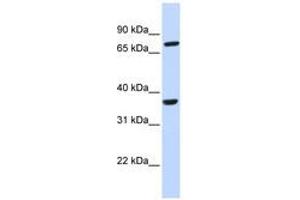 Image no. 1 for anti-Chemokine (C-C Motif) Receptor-Like 2 (CCRL2) (AA 36-85) antibody (ABIN6740363) (CCRL2 antibody  (AA 36-85))