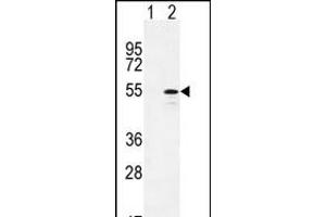Western blot analysis of CYP26B1 (arrow) using rabbit polyclonal CYP26B1 Antibody (C-term) (ABIN392528 and ABIN2842083). (CYP26B1 antibody  (C-Term))