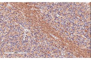 Immunohistochemistry (IHC) image for anti-Tubulin Polymerization Promoting Protein (Tppp) (Internal Region) antibody (ABIN571099)
