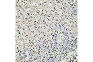 Immunohistochemistry of paraffin-embedded human esophagus using TMC1 antibody (ABIN6134923, ABIN6149240, ABIN6149242 and ABIN6224704) at dilution of 1:100 (40x lens).