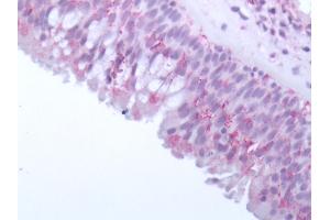 Human Olfactory Mucosa: Formalin-Fixed, Paraffin-Embedded (FFPE) (OR10J5 antibody  (Extracellular Domain))