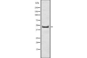 Western blot analysis of DUX4 using Jurkat whole cell lysates (DUX4 antibody)