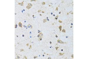 Immunohistochemistry of paraffin-embedded rat brain using PDP1 antibody (ABIN6132860, ABIN6145404, ABIN6145405 and ABIN6221944) at dilution of 1:100 (40x lens). (PDP antibody  (AA 278-537))