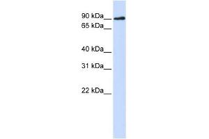 DCLRE1C antibody used at 1 ug/ml to detect target protein.