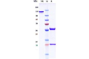 Anti-CD36 Reference Antibody (Ona Thera Patent Anti-Cd36) on SDS-PAGE under reducing (R) condition.