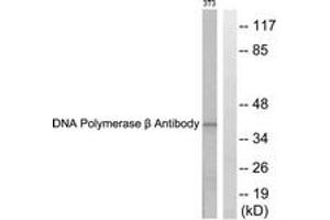 Western blot analysis of extracts from NIH-3T3 cells, using DNA Polymerase beta Antibody. (POLB antibody  (AA 286-335))