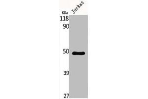 Western Blot analysis of Jurkat cells using MNT Polyclonal Antibody (MNT antibody  (Internal Region))