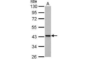 WB Image IVD antibody detects IVD protein by Western blot analysis. (IVD antibody)