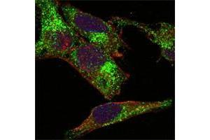 Confocal immunofluorescence analysis of Hela cells using INHA antibody (green). (Inhibin alpha antibody)