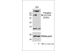 Western Blotting (WB) image for anti-Cell Division Cycle 25 Homolog A (S. Pombe) (CDC25A) (pSer124) antibody (ABIN389527)