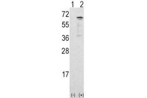 Western blot analysis of CAMKK1 antibody and 293 cell lysate either nontransfected (Lane 1) or transiently transfected with the CAMKK1 gene (2). (CAMKK1 antibody  (AA 337-369))