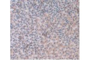 IHC-P analysis of Rat Adrenal Gland Tissue, with DAB staining.