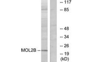 Western blot analysis of extracts from COLO cells, using MOBKL2B Antibody.